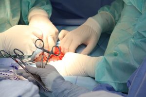 liver transplant